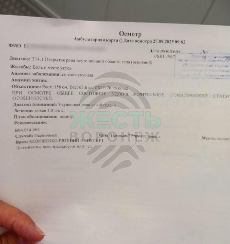 В центре Воронежа бродячая собака прокусила ногу 58-летней женщине