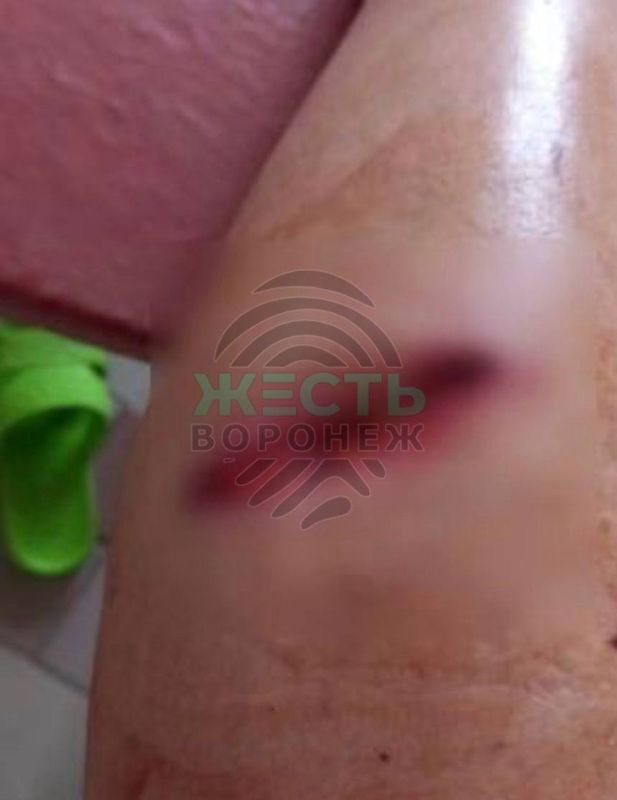 В центре Воронежа бездомная собака напала на женщину