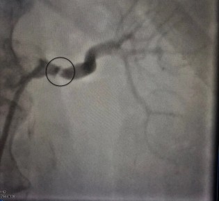 ����������� ����� �������� ��������� � ������ ����������, ������� �������� �������� � ���������