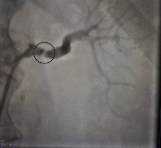 ����������� ����� ������ ��������� � ������ ������ ����������, ������� ������ �������� ����� �������