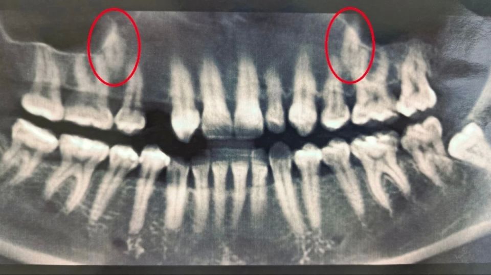 ����������� ����������� ������� 38-������ ������� � ����� ���������������� ������ � �������� ����