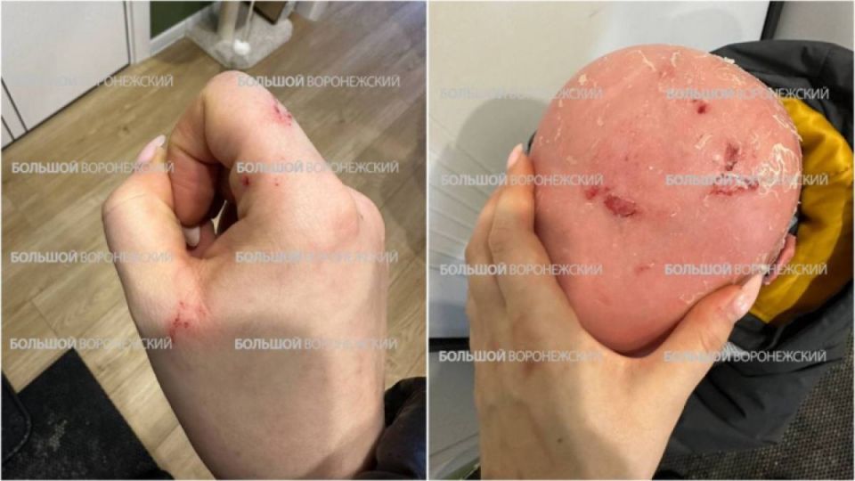 Сосульки упали на ребёнка-инвалида у ТЦ «Европа» в Воронеже