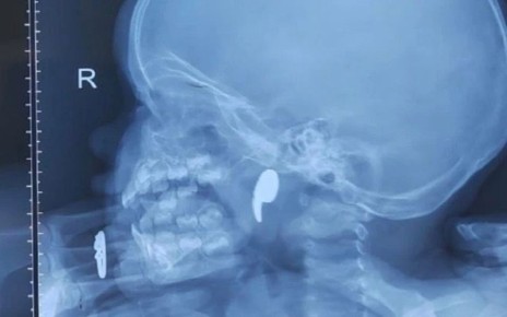 ������ �� ���������� 1,5-��������� ������� �������� ����� ������������������������� ��������� ����� �1