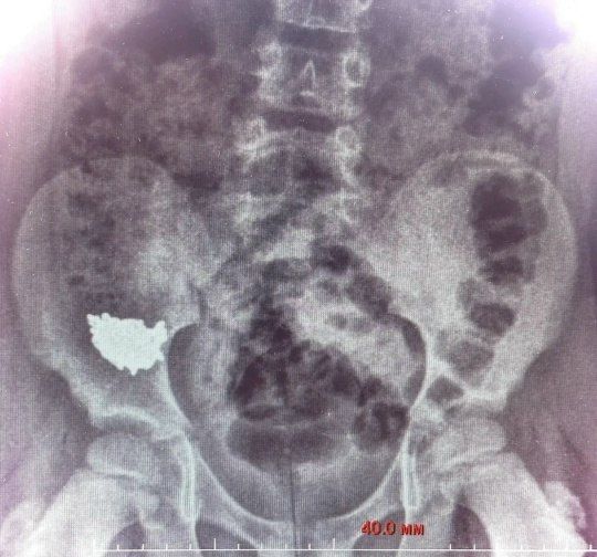 � �������� ������� ��������� 20-������������� �������