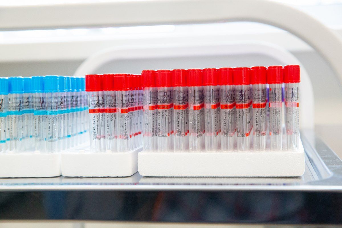 Математика против эпидемии: воронежские учёные описали ВИЧ с помощью уравнений