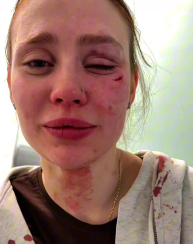 «Кто мартышка?» Полицейские установили личность мужчины, который напал на девушку у караоке-бара
