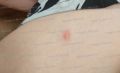 Удар ракеткой по затылку выстрел в ногу и угрозы: как 35-летний воронежец наказал школьника