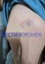 Инвалида, напавшего на трёх детей в Воронеже, задержали